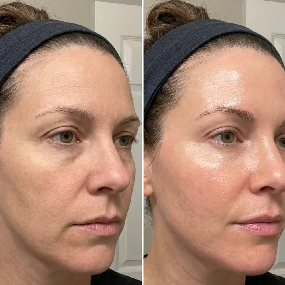 Carol S.: a close angled selfie of a woman in a headband twice, her jaw and cheek firmer in the second